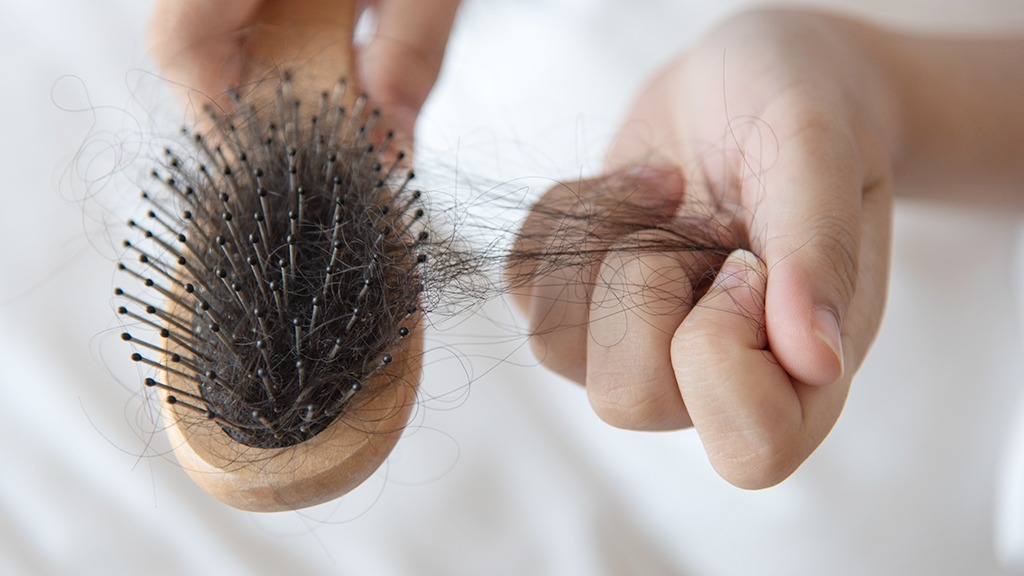 保養知識-綠果學堂-頭皮不健康也是導致掉髮的原因之一