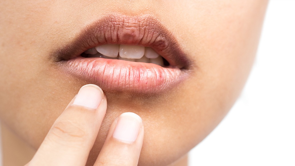 產品實用-綠果學堂-不只是皮膚，連嘴唇也會老化